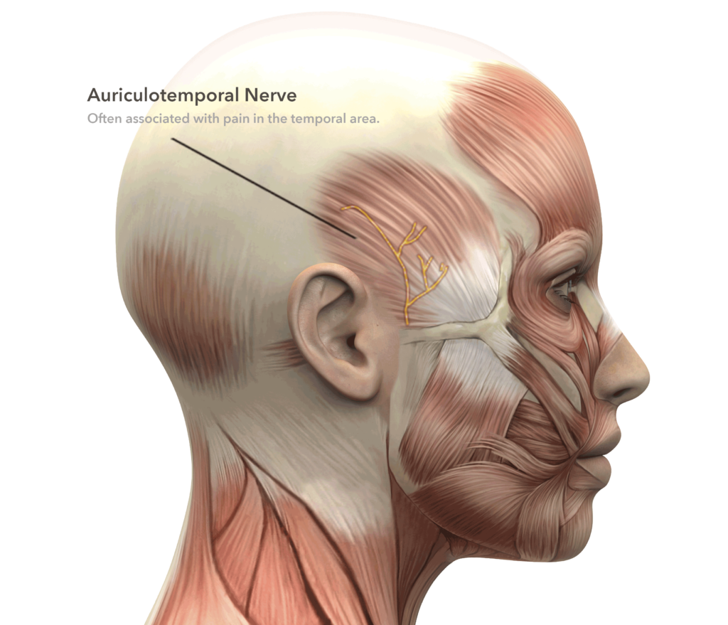 Migraine Headache Surgery Zones | Located In Bangor, Maine
